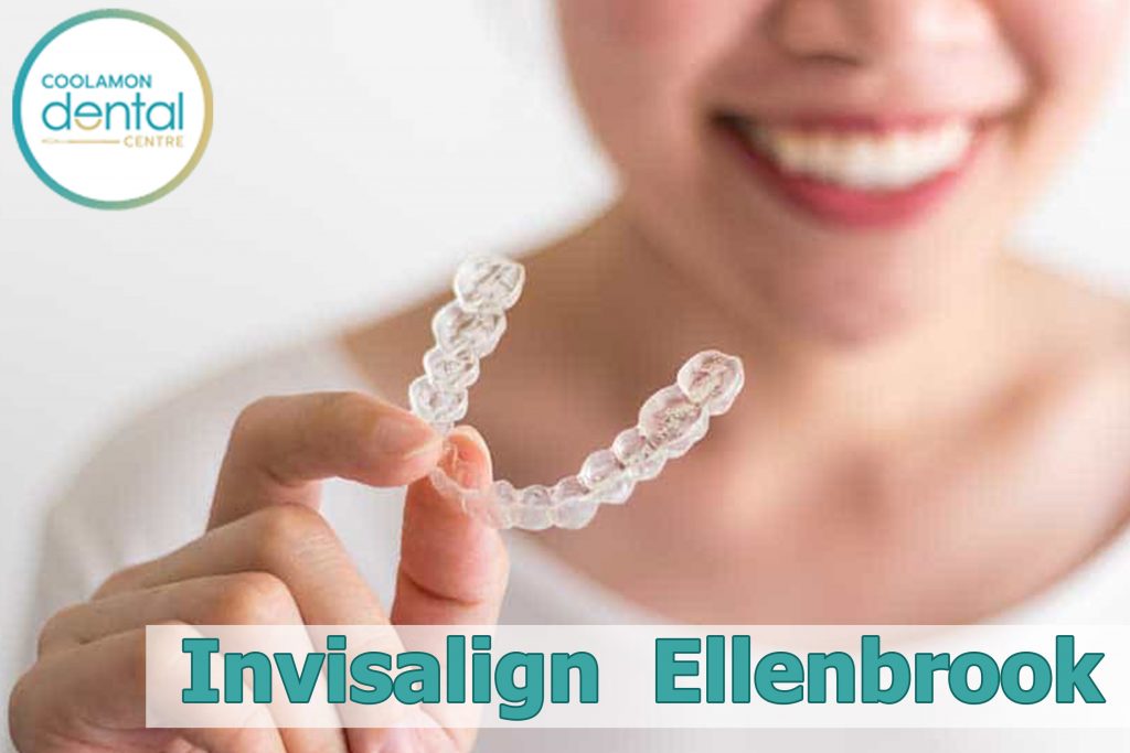 Affordable Invisalign in Ellenbrook